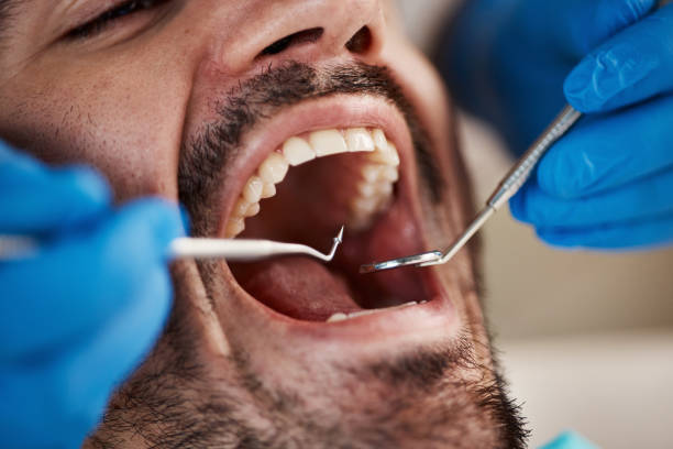Best Emergency Dental Services for Seniors in South Boston, VA